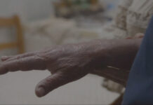 APCL lança alertas sobre o Linfoma Cutâneo de Células T (LCCT)