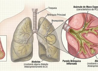 Mais de metade das pessoas com fibrose quística em Portugal já são adultas
